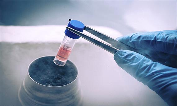 درمان بی‌اختیاری ادرار با سلول‌های بنیادی توسط محققان کشور