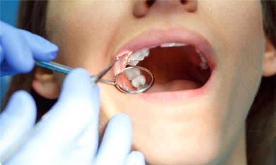 نیوزیلند استفاده از آمالگام در دندان کودکان را ممنوع کرد