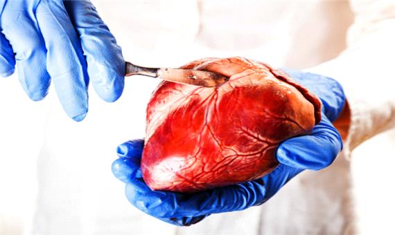 بازسازی قلب در هنگام مرگ سلول‌ها