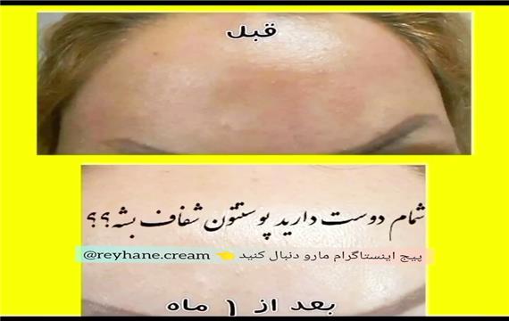 چگونه لک ها و مشکلات پوستی را در کمترین زمان درمان کنیم؟