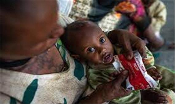یونیسف: 100 هزار کودک تیگرای در معرض خطر مرگ ناشی از سوءتغذیه قرار دارند