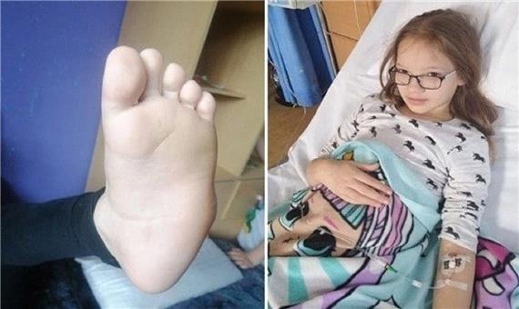 دختر بچه‌ای که می‌خواهد پزشکان پای او را قطع کنند