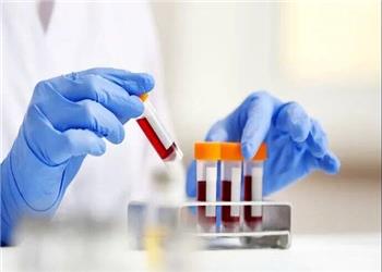 غربالگری کلسترول کودکان ضروری است؟