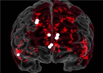نانورباتها با موفقیت خونریزی مغز را متوقف کردند