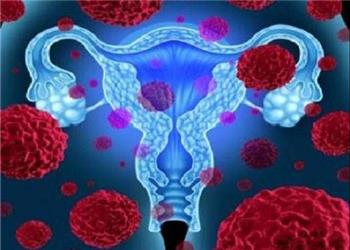 فیبروم رحمی با خطر بیماری قلبی در زنان مرتبط است