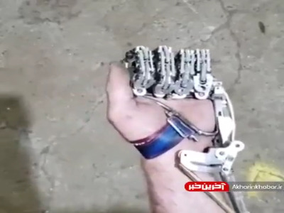 قطع عضو نقص نیست!