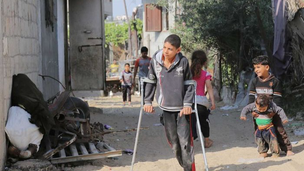 ۳۰ فلسطینی هر روز در غزه دچار معلولیت می‌شوند