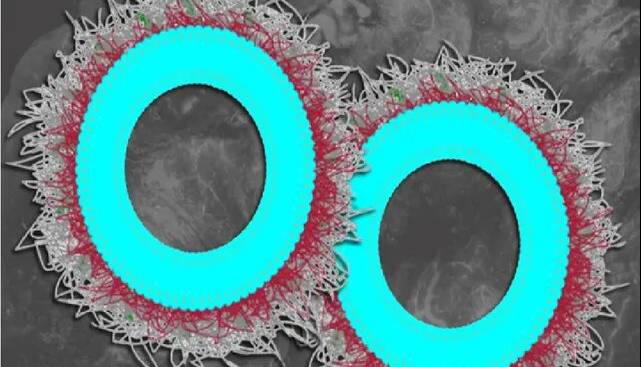 نابودی بیش از ۸۰ درصدی تومورهای تخمدان با نانوذرات جدید