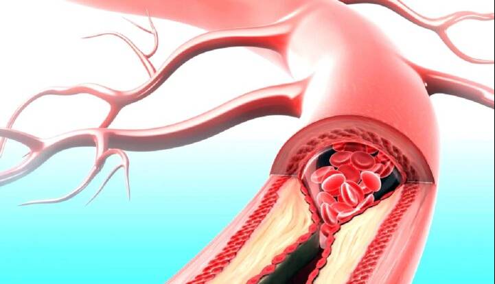 دارویی که همزمان با بیماری قلبی و دیابت مقابله می‌کند