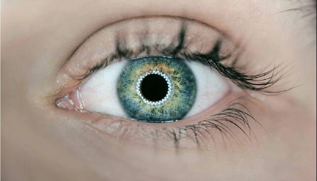 بازگشت بینایی یک بیمار با قرنیه چاپ سه‌بعدی